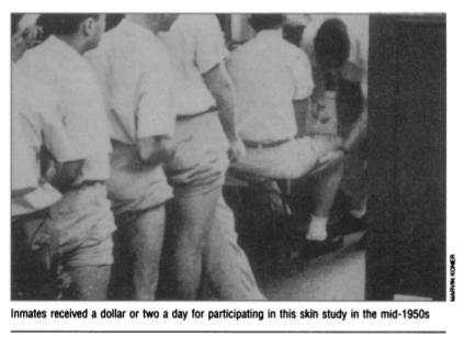 Inmates received a dollar or two a day for participating in this skin study in the 1950's.